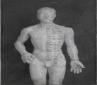 Acupuncture with Dr. Sean McConnell at Physio F/X